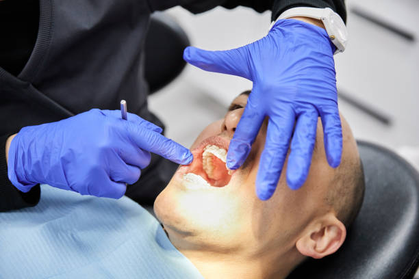 Best Emergency Wisdom Teeth Removal in Hazleton, PA